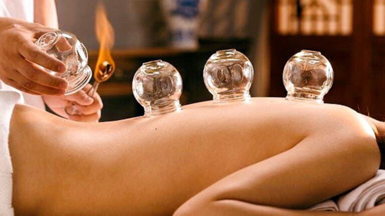 Cupping Therapy - Thérapies - Champaca